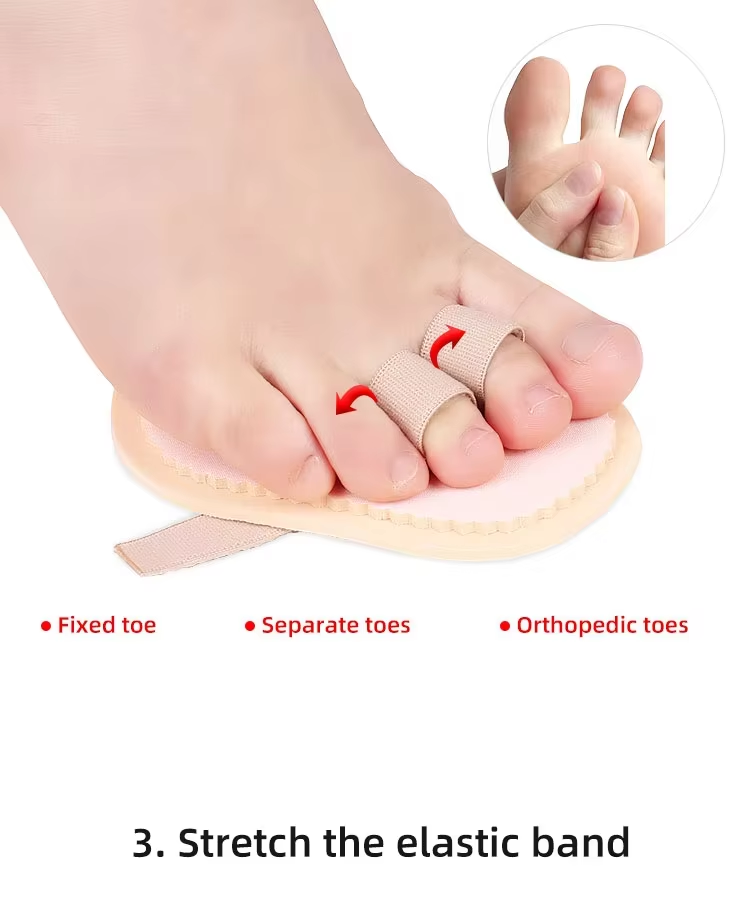 Orthopedic toe pads for shoes with elastic band - doctor-recommended for toe alignment